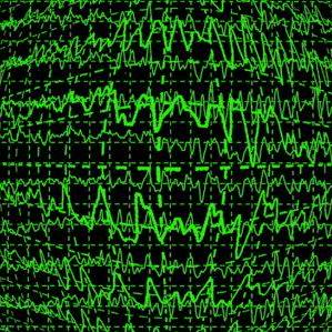 @neurommsig-epilepsy