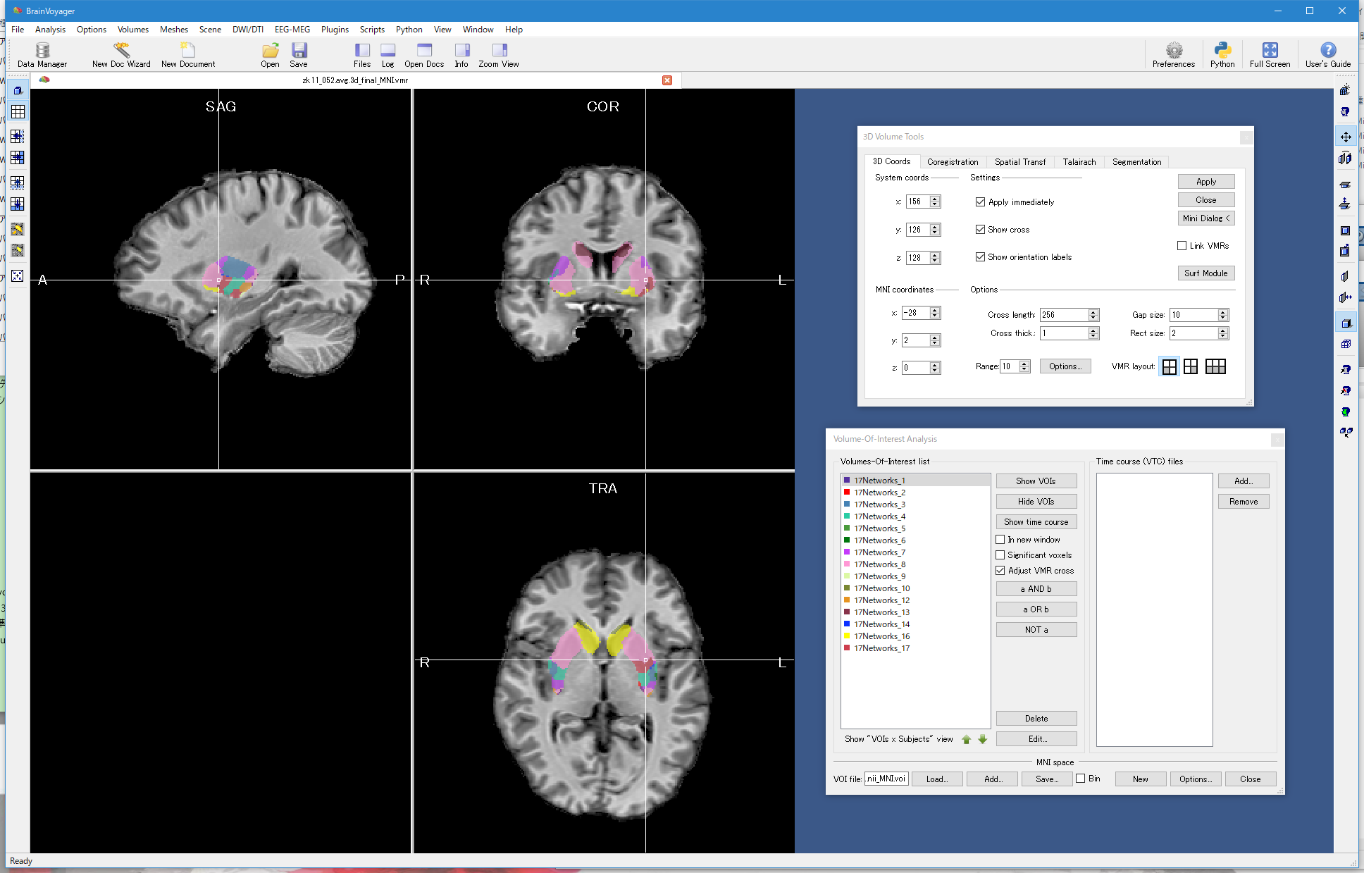 Choi_JNeurophysiol12_MNI152_VOIs.png